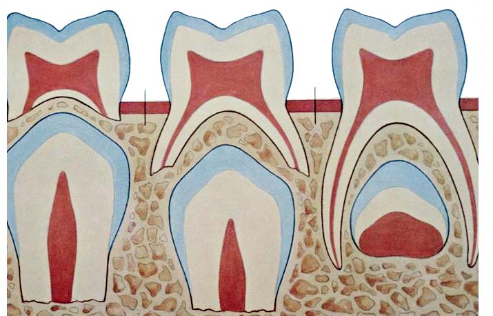 乳歯の根の内側